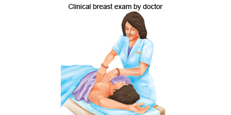 Clinical Breast Examination by doctor